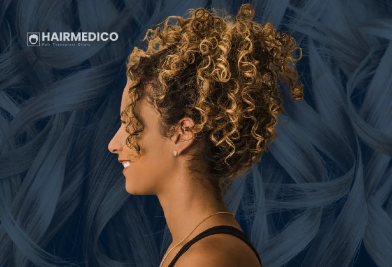 Why Afro Hair Transplant Is Technically Harder