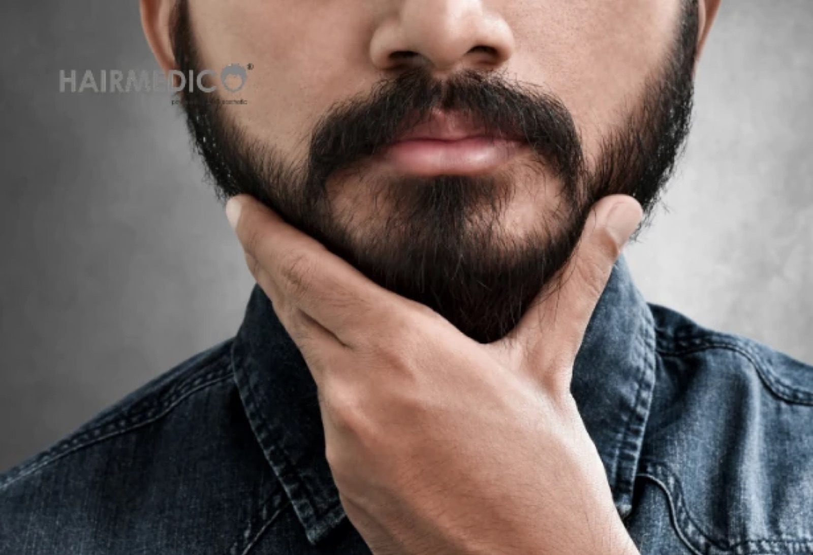 Beard Transplant — Complete FUE Guide 2026