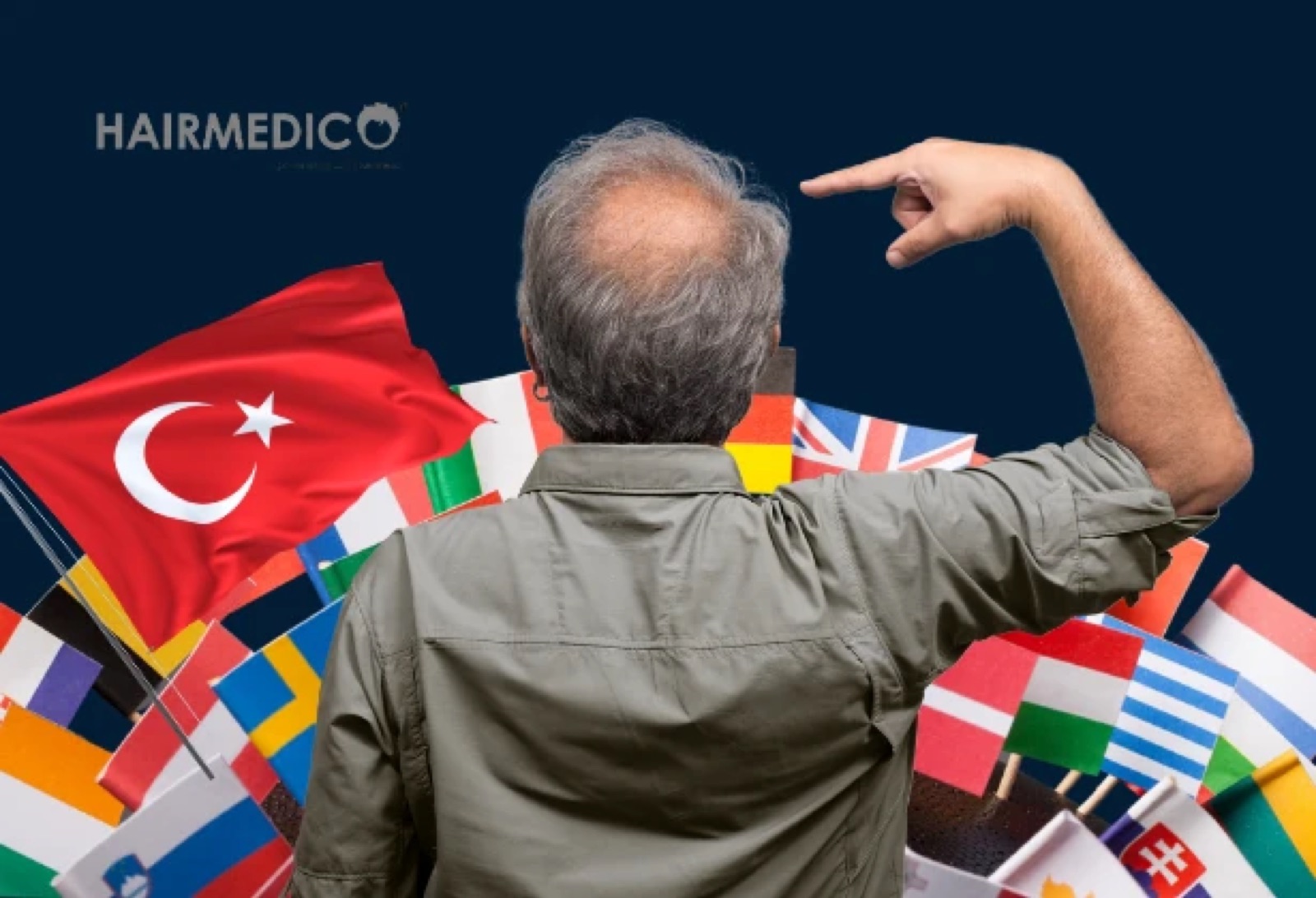 Best Countries for Hair Transplant 2025