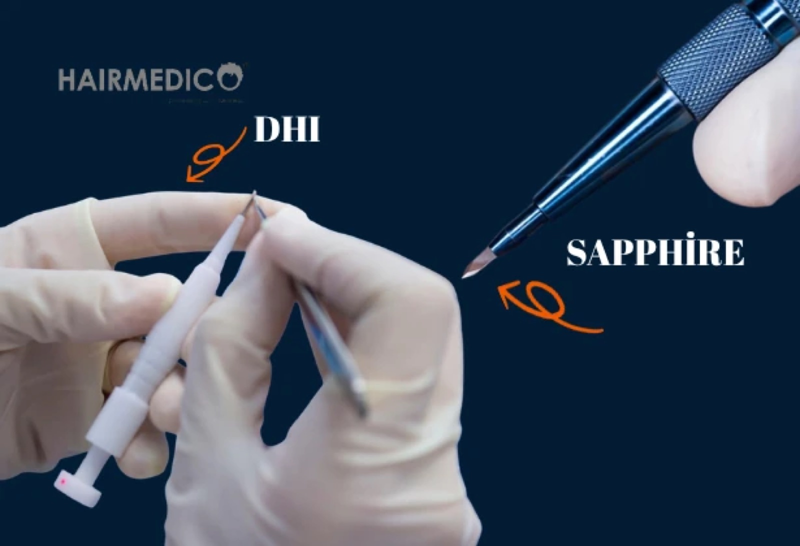 DHI vs FUE Hair Transplant — Which Is Better? 2026