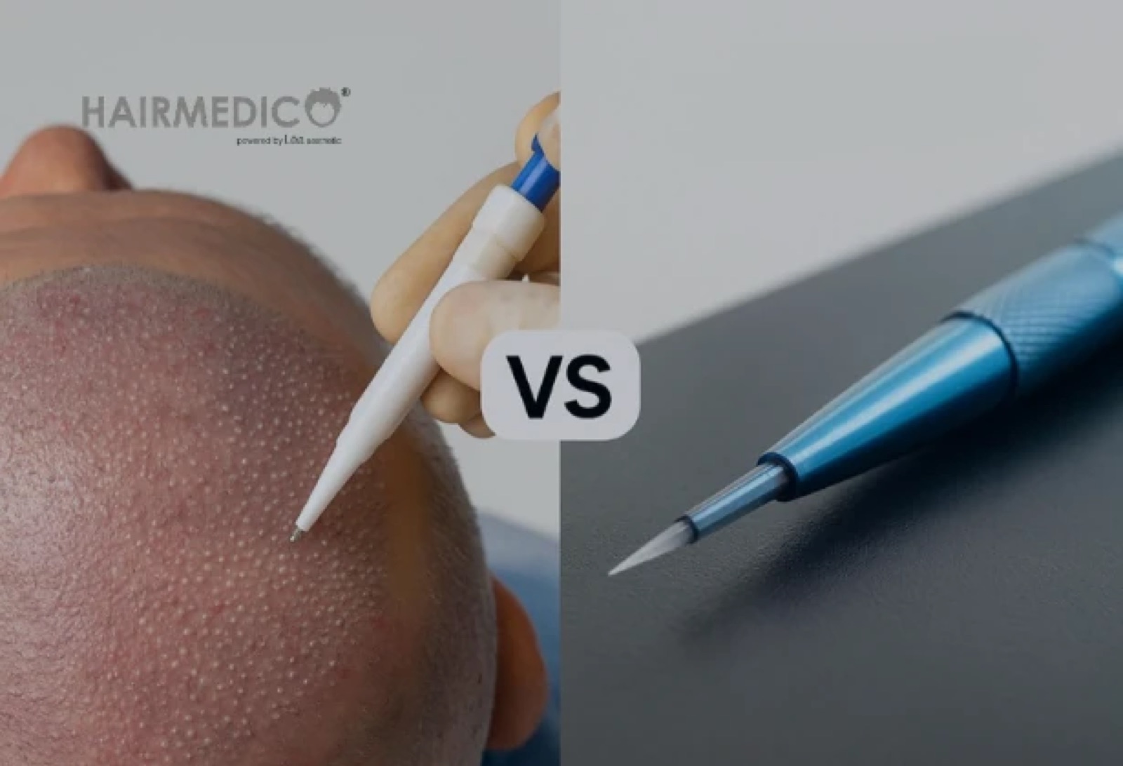 FUE vs DHI Hair Transplant — Which Technique