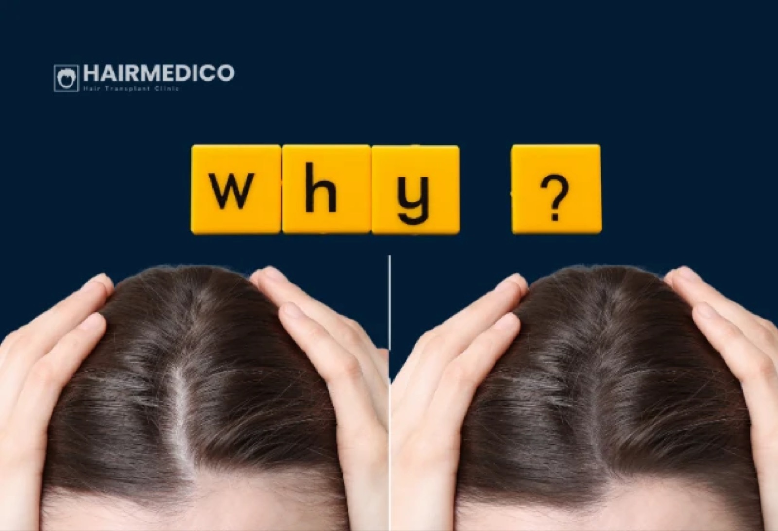 Hair Density vs Graft Count: What Really Matters?