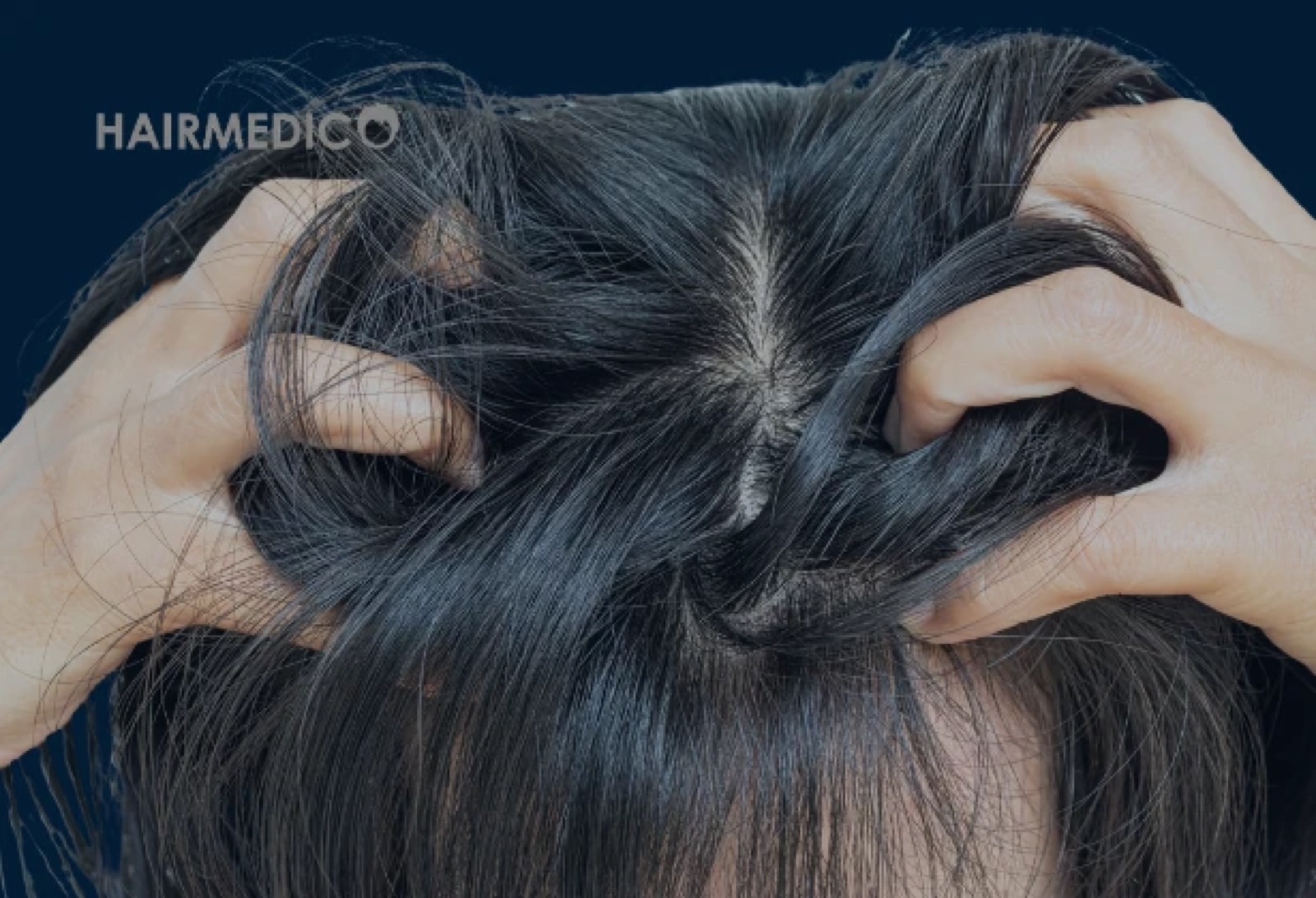 Hair Transplant and Skin Type — Scalp Health