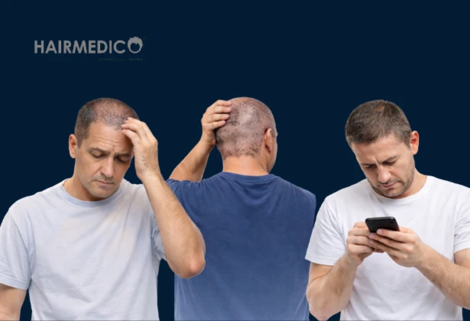 What Is Shock Loss After Hair Transplant? Is It Normal?