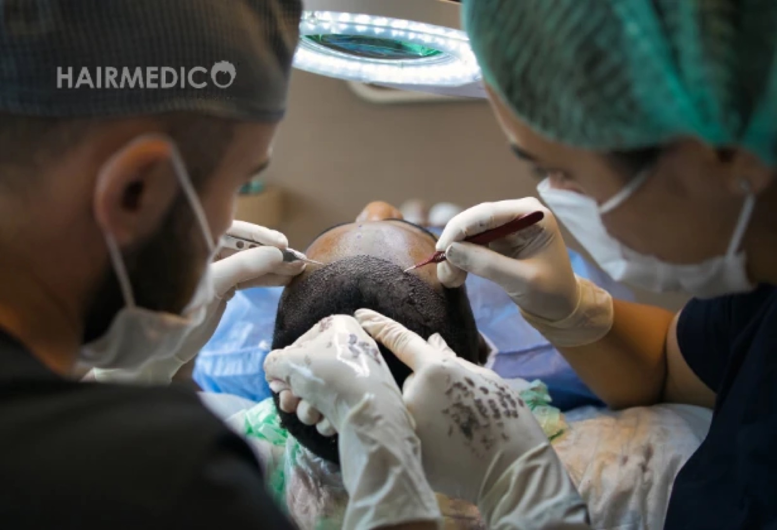 Hair Transplant Trends & Innovations 2025