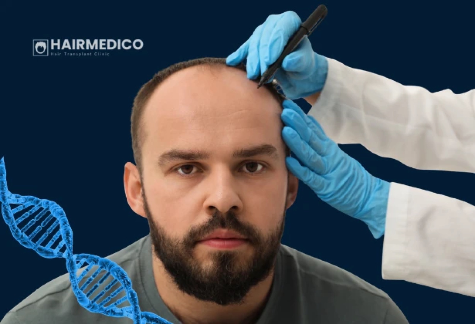 Microvascular Healing After Hair Transplant: