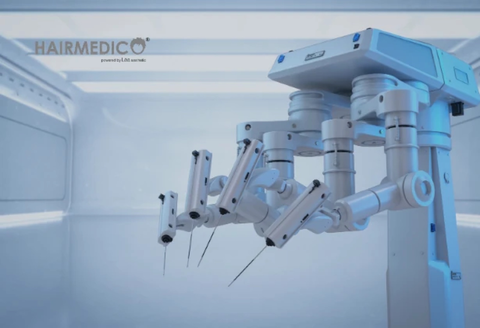 Robotic Hair Transplant 2025 — Myths vs Reality