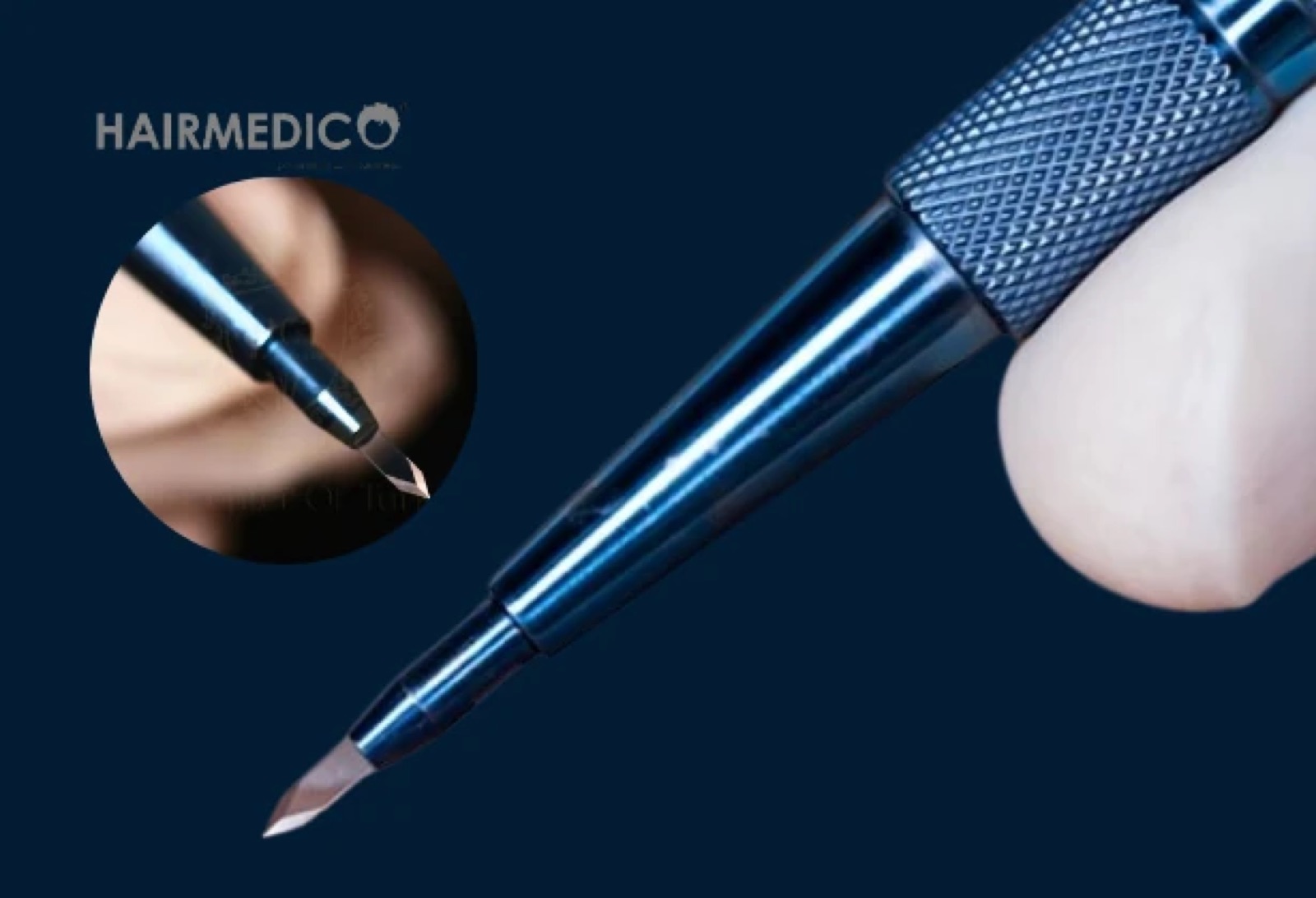 Sapphire FUE Hair Transplant in Turkey:...
