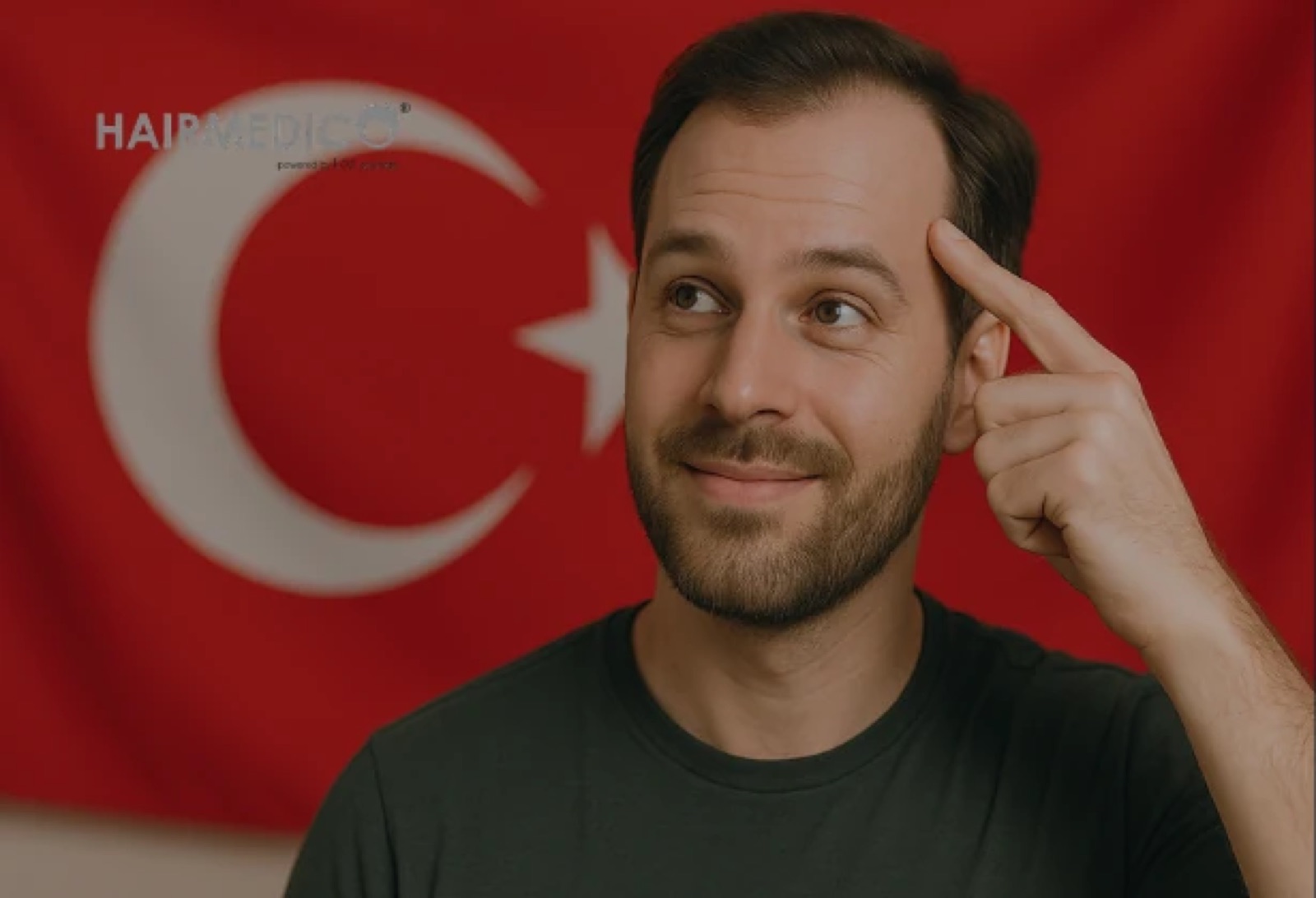 Why US Patients Choose Turkey for Hair Transplant