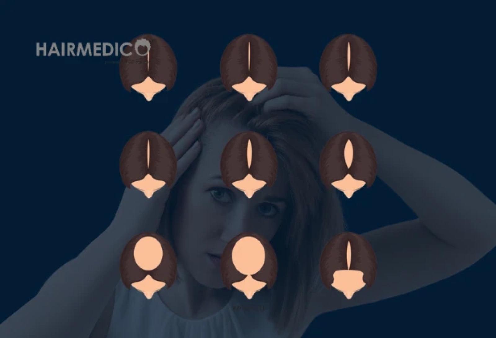Hair Transplant for Women — Complete Clinical Guide 2026