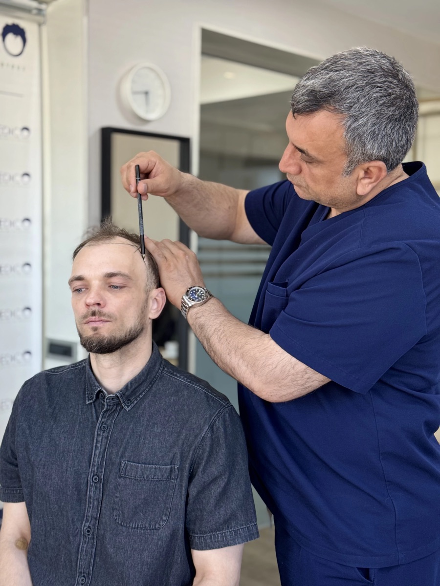 Dr. Arslan Musbeh designing a patient's hairline using anatomical references