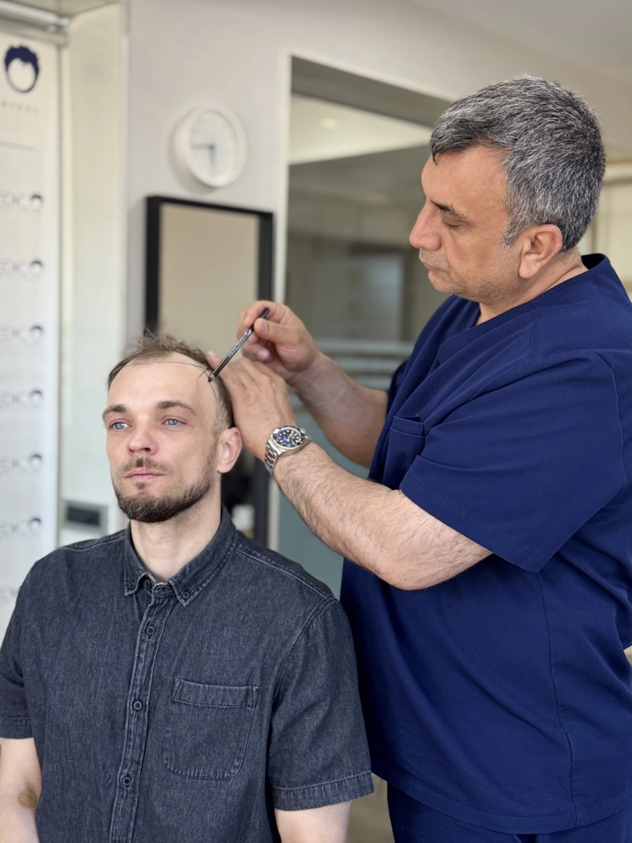 Dr. Arslan Musbeh designing a patient's hairline