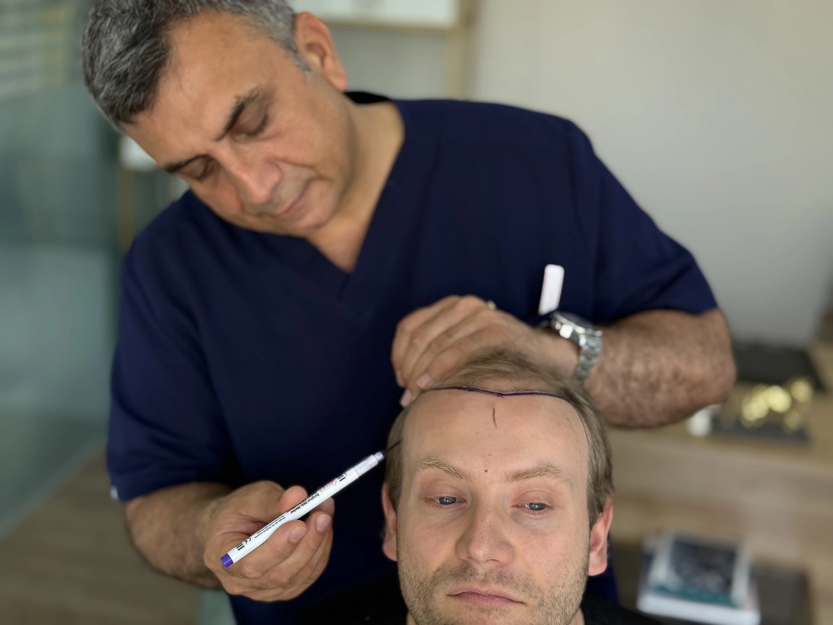 Dr. Arslan Musbeh marking the frontal hairline before surgery